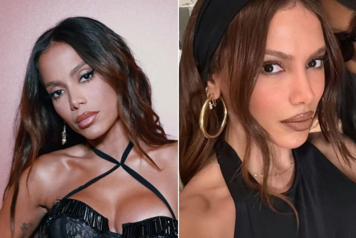 Anitta hoje: a verdade por tr&aacute;s das sucessivas pl&aacute;sticas