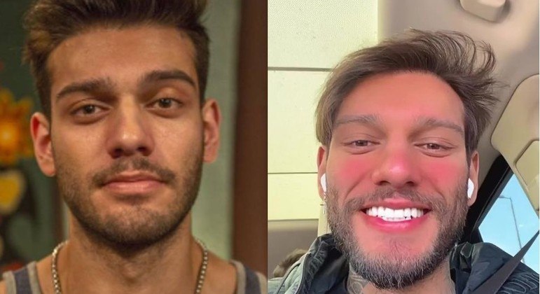 Lucas Lucco hoje: a mudan&ccedil;a radical ap&oacute;s reverter o botox