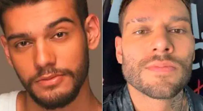 Lucas Lucco hoje: a mudan&ccedil;a radical ap&oacute;s reverter o botox